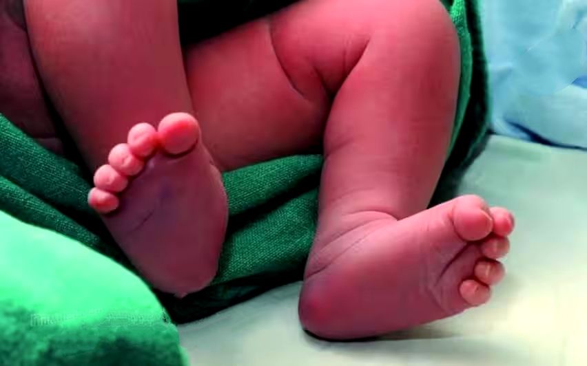 നവജാതശിശുക്കളിൽ ജനിതകവൈകല്യം കൂടുന്നു; ഏറ്റവും കൂടുതൽ തിരുവനന്തപുരത്ത്