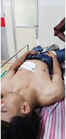 ബി സോൺ കലോത്സവത്തിനിടെ എസ്.എഫ്.ഐ.-യു.ഡി.എസ്.എഫ്. സംഘർഷം