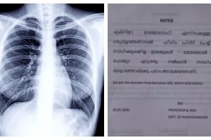 കോഴിക്കോട് മെഡിക്കൽ കോളേജിൽ എക്സ് റേ ഫിലിമില്ല, മൊബൈൽ ഫോണിൽ ഫോട്ടോയെടുക്കാൻ നിർദേശം, രോ​ഗികൾ വലയുന്നു