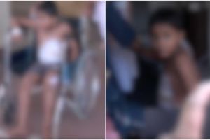 കൊല്ലത്ത് പത്തു വയസ്സുകാരന് ശരീരമാസകലം പൊള്ളലേറ്റു; പൊളളലേൽപ്പിച്ചത് അച്ഛനെന്ന് കുട്ടിയുടെ മൊഴി, ചൂട് വെള്ളം വീണതെന്ന് ബന്ധുക്കൾ