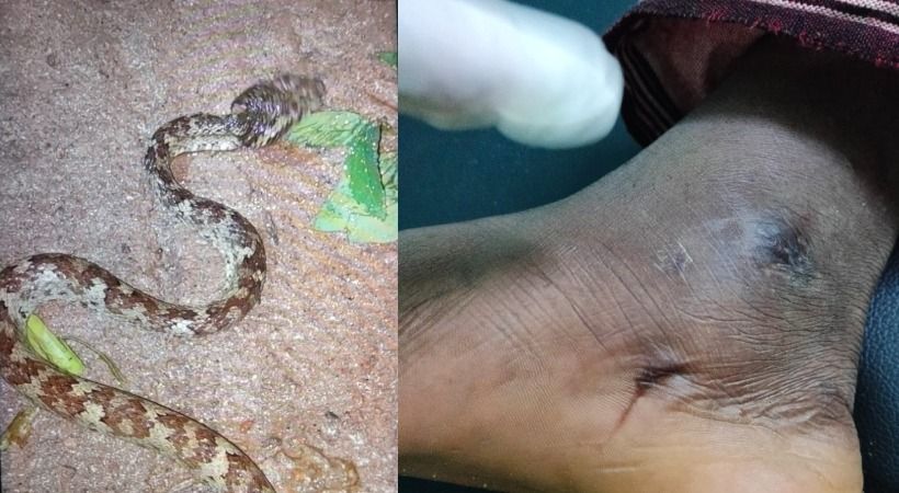 വീണ്ടും പാമ്പ് ഭീതി; കോഴിക്കോട് യുവാവിന് പാമ്പുകടിയേറ്റു