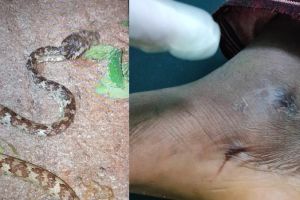 വീണ്ടും പാമ്പ് ഭീതി; കോഴിക്കോട് യുവാവിന് പാമ്പുകടിയേറ്റു