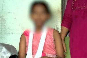വിദ്യാർത്ഥിയുടെ കൈ തല്ലിയൊടിച്ച സംഭവം: അധ്യാപകനെ സസ്‌പെൻഡ് ചെയ്തു