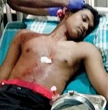 കുമ്മങ്കോട് അജ്ഞാതജീവിയുടെ ആക്രമണം: രണ്ടുപേർക്ക് പരിക്ക്; പുലിയാകാമെന്ന് സംശയം