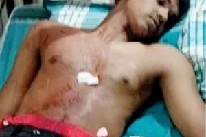 കുമ്മങ്കോട് അജ്ഞാതജീവിയുടെ ആക്രമണം: രണ്ടുപേർക്ക് പരിക്ക്; പുലിയാകാമെന്ന് സംശയം